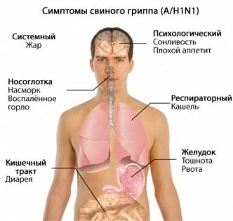 Свиной грипп A/H1N1 симптомы